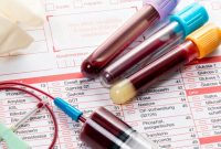 آزمایش خون ۵۰ نوع سرطان را شناسایی می کند