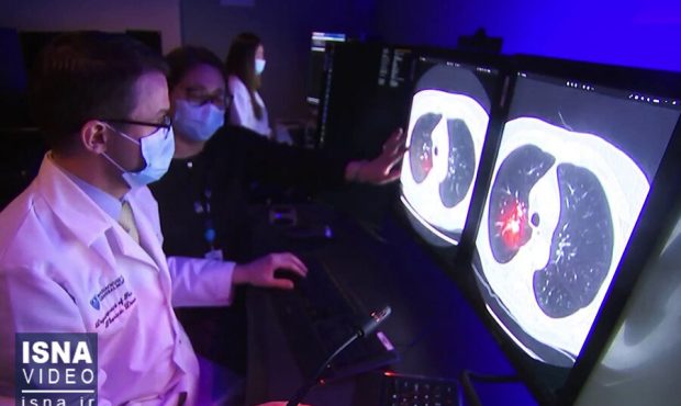 ویدیو/ تشخیص زودهنگام سرطان سینه با هوش مصنوعی