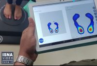 ویدیو/ تشخیص نارسایی قلبی توسط هوش مصنوعی با اسکن پا