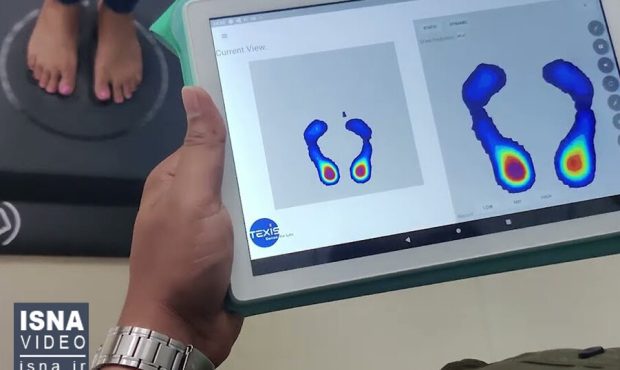 ویدیو/ تشخیص نارسایی قلبی توسط هوش مصنوعی با اسکن پا